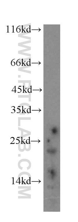 neurturin Rabbit anti-Human, Polyclonal, Proteintech 150 &mu;L; Unconjugated:Antibodies,