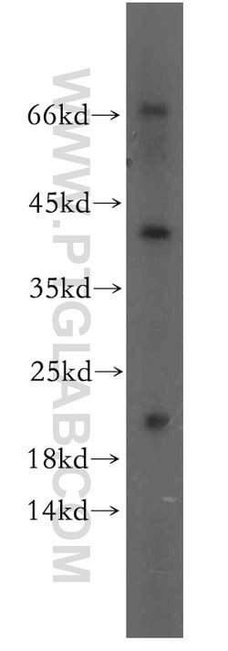 neurturin Rabbit anti-Human, Polyclonal, Proteintech 150 &mu;L; Unconjugated:Antibodies,