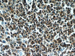 PTPRCAP / CD45AP Rabbit anti-Human, Polyclonal, Proteintech:Antibodies:Primary