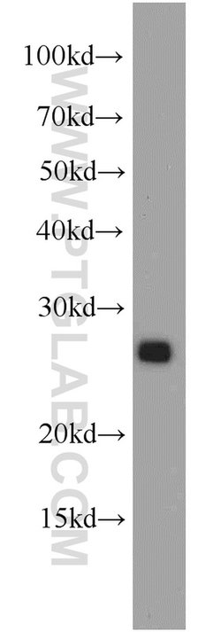 PTPRCAP / CD45AP Rabbit anti-Human, Polyclonal, Proteintech:Antibodies:Primary