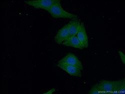 PYGM Rabbit anti-Human, Mouse, Rat, Polyclonal, Proteintech 150 &mu;L;