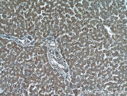 PYGM Rabbit anti-Human, Mouse, Rat, Polyclonal, Proteintech 150 &mu;L;