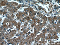 PYGM Rabbit anti-Human, Mouse, Rat, Polyclonal, Proteintech 150 &mu;L;