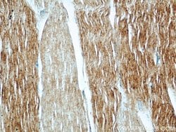 PYGM Rabbit anti-Human, Mouse, Rat, Polyclonal, Proteintech 150 &mu;L;