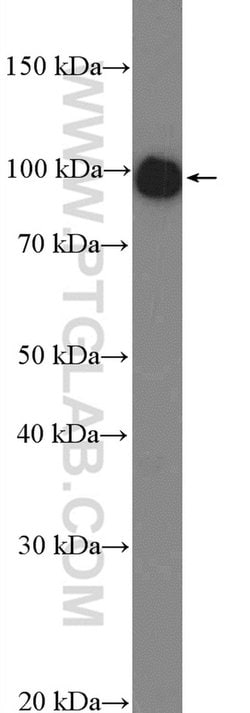 PYGM Rabbit anti-Human, Mouse, Rat, Polyclonal, Proteintech 150 &mu;L;