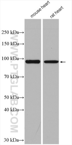 PYGM Rabbit anti-Human, Mouse, Rat, Polyclonal, Proteintech 150 &mu;L;