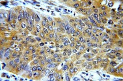TMF1 Rabbit anti-Human, Polyclonal, Proteintech 150 &mu;L; Unconjugated:Antibodies,