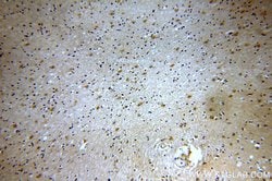 Tenascin-R Rabbit anti-Human, Polyclonal, Proteintech 150 &mu;L; Unconjugated:Antibodies,