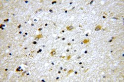 Tenascin-R Rabbit anti-Human, Polyclonal, Proteintech 150 &mu;L; Unconjugated:Antibodies,