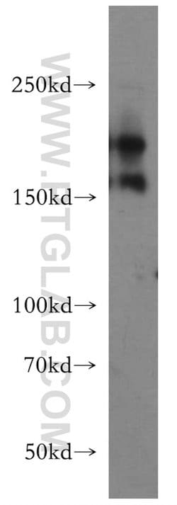 Tenascin-R Rabbit anti-Human, Polyclonal, Proteintech 150 &mu;L; Unconjugated:Antibodies,