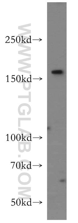 Tenascin-R Rabbit anti-Human, Polyclonal, Proteintech 150 &mu;L; Unconjugated:Antibodies,