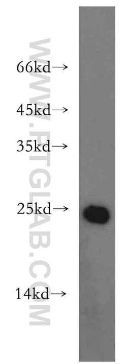 Urocortin Rabbit anti-Human, Mouse, Rat, Polyclonal, Proteintech 20 &mu;L | Buy Online | Proteintech | Fisher Scientific