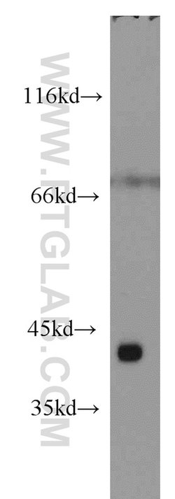 ST8SIA2 Rabbit anti-Human, Mouse, Rat, Polyclonal, Proteintech 150 &mu;L;