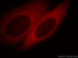 SLK Rabbit anti-Human, Mouse, Polyclonal, Proteintech 150 &mu;L; Unconjugated:Antibodies,