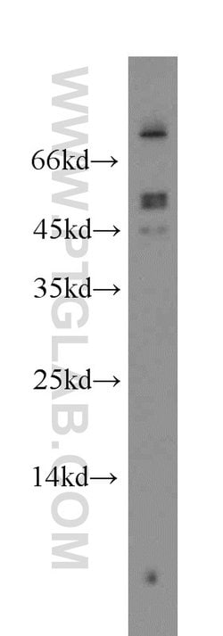 FOXJ3 Rabbit anti-Human, Polyclonal, Proteintech 150 &mu;L; Unconjugated:Antibodies,