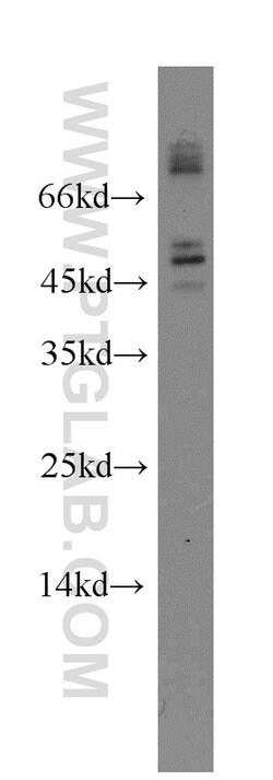 FOXJ3 Rabbit anti-Human, Polyclonal, Proteintech 150 &mu;L; Unconjugated:Antibodies,