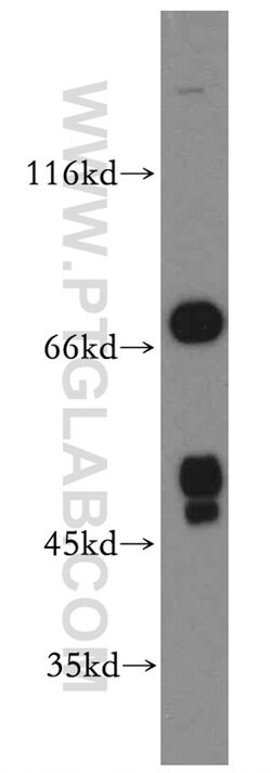 FOXJ3 Rabbit anti-Human, Polyclonal, Proteintech 150 &mu;L; Unconjugated:Antibodies,