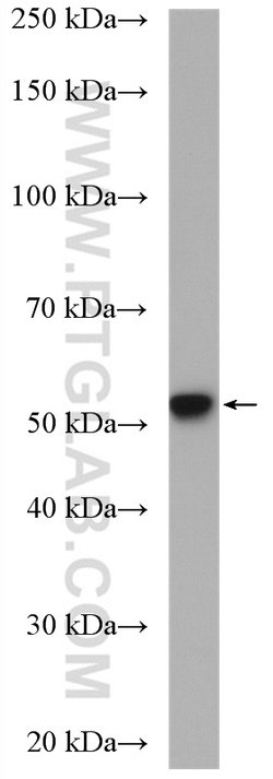 ADRA1A Rabbit anti-Human, Mouse, Rat, Polyclonal, Proteintech 150 &mu;L;