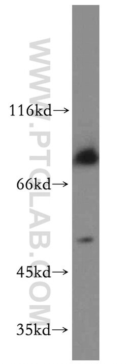 ADRA1A Rabbit anti-Human, Mouse, Rat, Polyclonal, Proteintech 150 &mu;L;