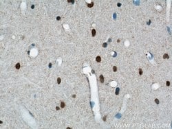 BRCA2 Rabbit anti-Human, Mouse, Rat, Polyclonal, Proteintech 150 &mu;L;