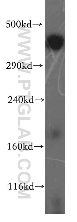 BRCA2 Rabbit anti-Human, Mouse, Rat, Polyclonal, Proteintech 150 &mu;L;