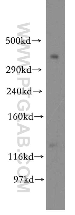 BRCA2 Rabbit anti-Human, Mouse, Rat, Polyclonal, Proteintech 150 &mu;L;