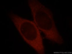 Catalase Rabbit anti-Human, Polyclonal, Proteintech:Antibodies:Primary