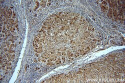 Catalase Rabbit anti-Human, Polyclonal, Proteintech:Antibodies:Primary