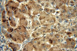 Catalase Rabbit anti-Human, Polyclonal, Proteintech:Antibodies:Primary