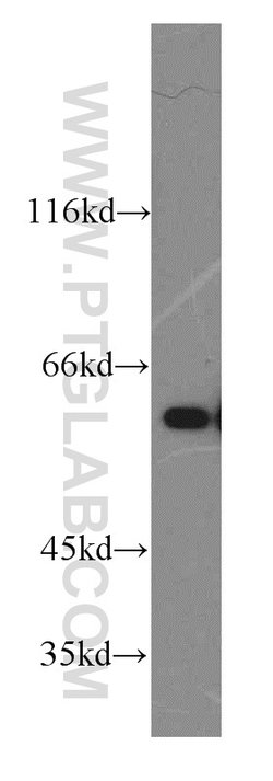 Catalase Rabbit anti-Human, Polyclonal, Proteintech:Antibodies:Primary