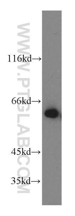 Catalase Rabbit anti-Human, Polyclonal, Proteintech:Antibodies:Primary
