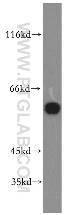 Catalase Rabbit anti-Human, Polyclonal, Proteintech:Antibodies:Primary
