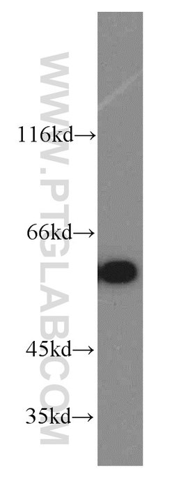 CCT6A Rabbit anti-Human, Mouse, Polyclonal, Proteintech 150 &mu;L | Buy Online | Proteintech Group Inc | Fisher Scientific
