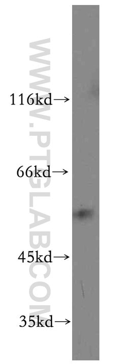 CCT6A Rabbit anti-Human, Mouse, Polyclonal, Proteintech 150 &mu;L | Buy Online | Proteintech Group Inc | Fisher Scientific