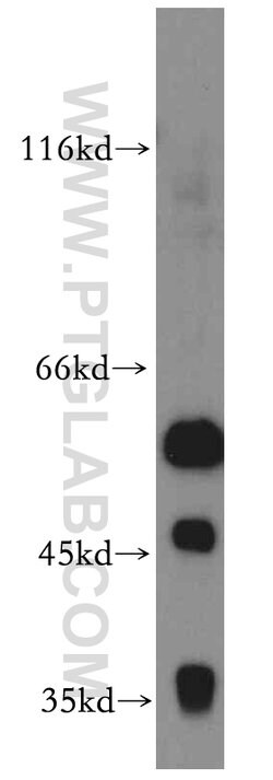 CCT6A Rabbit anti-Human, Mouse, Polyclonal, Proteintech 150 &mu;L | Buy Online | Proteintech Group Inc | Fisher Scientific