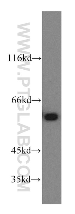 CCT6A Rabbit anti-Human, Mouse, Polyclonal, Proteintech 150 &mu;L | Buy Online | Proteintech Group Inc | Fisher Scientific