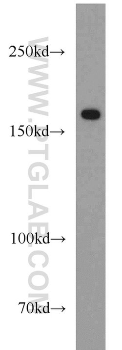Collagen Type XVI Rabbit anti-Human, Mouse, Rat, Polyclonal, Proteintech 150 &mu;L | Buy Online | Proteintech Group Inc | Fisher Scientific