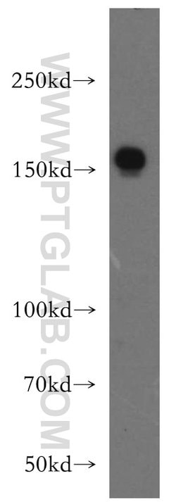 Collagen Type XVI Rabbit anti-Human, Mouse, Rat, Polyclonal, Proteintech 150 &mu;L | Buy Online | Proteintech Group Inc | Fisher Scientific