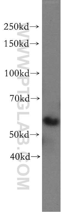 RtcB Rabbit anti-Human, Mouse, Polyclonal, Proteintech 150 &mu;L; Unconjugated:Antibodies,