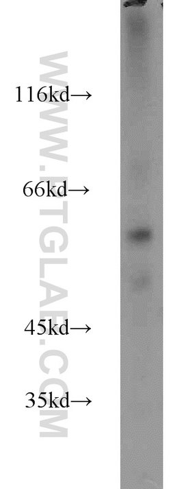 ZBTB37 Rabbit anti-Human, Mouse, Rat, Polyclonal, Proteintech 150 &mu;L | Buy Online | Proteintech Group Inc | Fisher Scientific