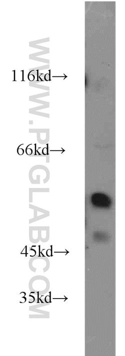 ZBTB37 Rabbit anti-Human, Mouse, Rat, Polyclonal, Proteintech 150 &mu;L | Buy Online | Proteintech Group Inc | Fisher Scientific