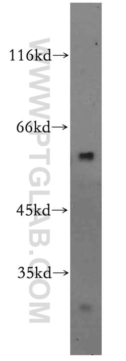 ZBTB37 Rabbit anti-Human, Mouse, Rat, Polyclonal, Proteintech 150 &mu;L | Buy Online | Proteintech Group Inc | Fisher Scientific