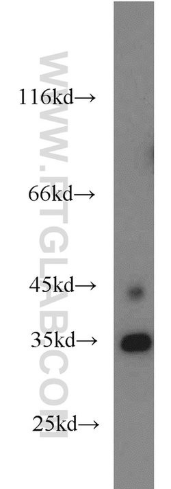 NUP53 Rabbit anti-Human, Mouse, Rat, Polyclonal, Proteintech 20 &mu;L;
