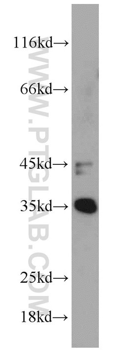 NUP53 Rabbit anti-Human, Mouse, Rat, Polyclonal, Proteintech 20 &mu;L;