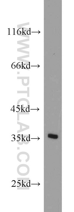 NUP53 Rabbit anti-Human, Mouse, Rat, Polyclonal, Proteintech 20 &mu;L;