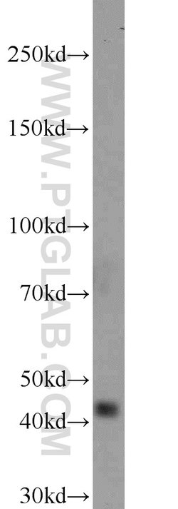 NUP53 Rabbit anti-Human, Mouse, Rat, Polyclonal, Proteintech 20 &mu;L;