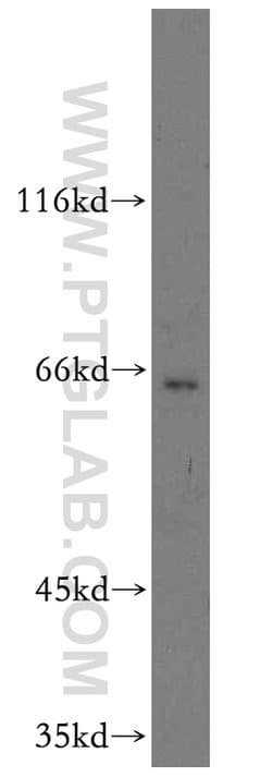 TM7SF3 Rabbit anti-Human, Mouse, Polyclonal, Proteintech 20 &mu;L; Unconjugated 