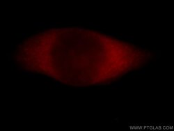 CALCOCO1 Rabbit anti-Human, Mouse, Rat, Polyclonal, Proteintech 150 &mu;L;