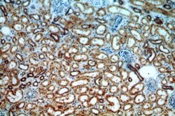CALCOCO1 Rabbit anti-Human, Mouse, Rat, Polyclonal, Proteintech 150 &mu;L;