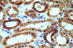 CALCOCO1 Rabbit anti-Human, Mouse, Rat, Polyclonal, Proteintech 150 &mu;L;